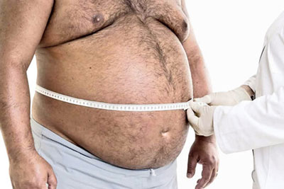 Cirurgia Bariátrica São Paulo